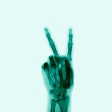 X-Ray of Hand Doing Peace Sign